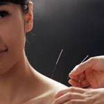 acupuncture treatment in pune