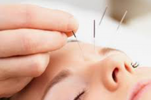acupuncture treatment in pune