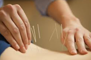 acupuncture treatment in pune