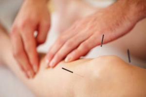 acupuncture treatment in pune
